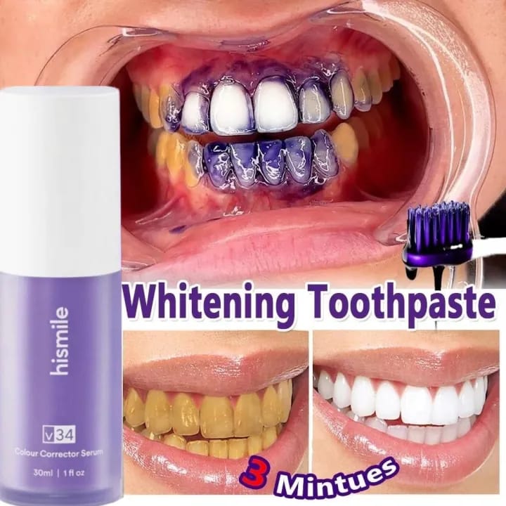 Hi-Smile Teeth Whitening Product
